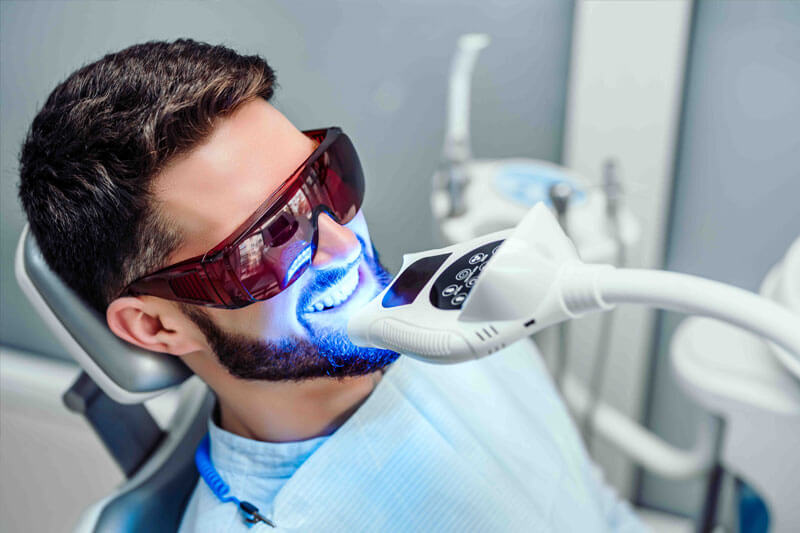 laserowe wybielanie zębów w gliwicach